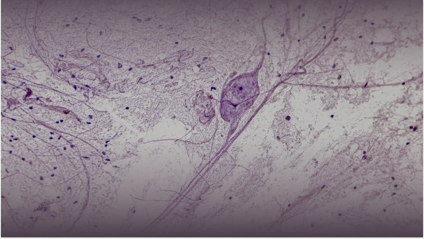 The surgeon who left the OR for AI product development